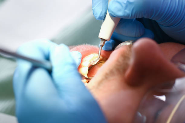 Best Emergency Tooth Extraction in Pleasureville, KY